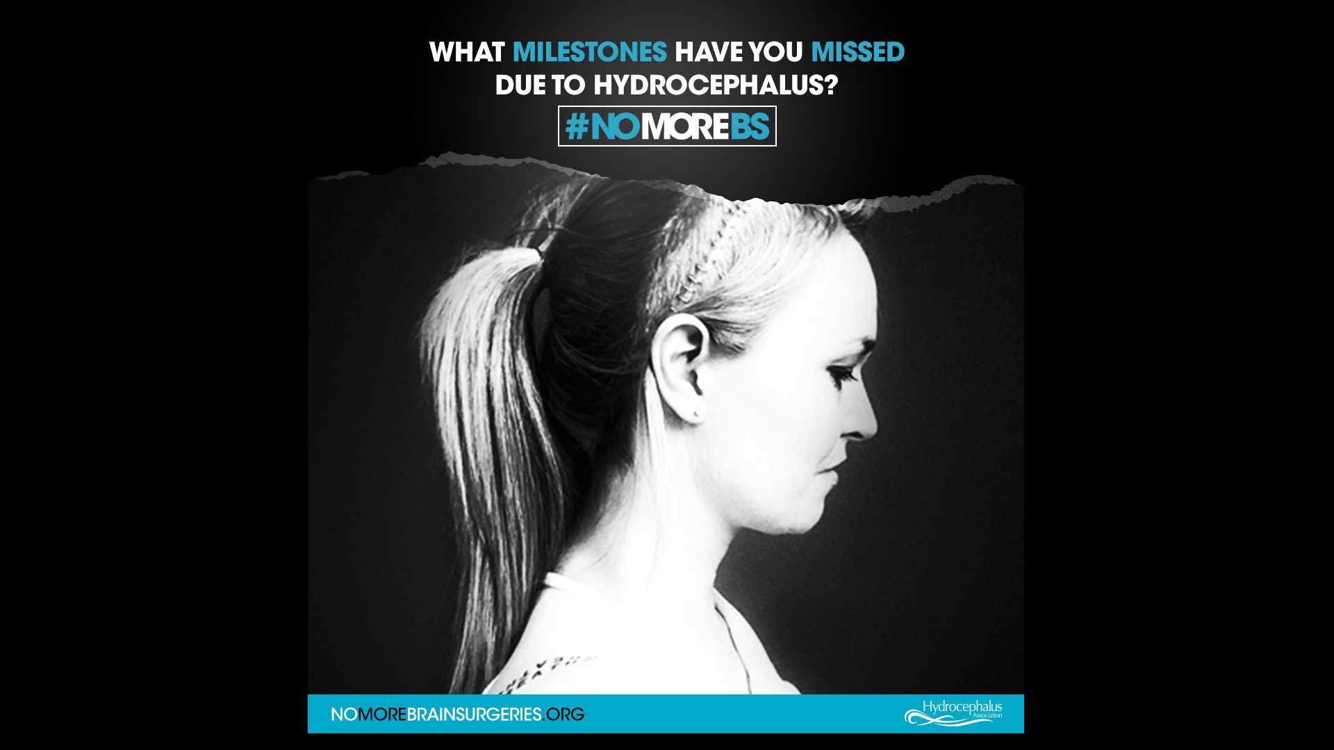 Nominee Hydrocephalus Association #NOMOREBS